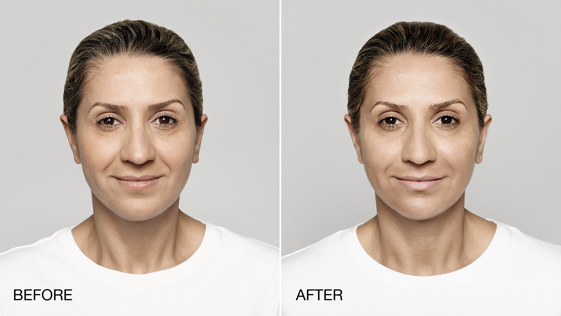 Before. Before after. Face before and after. Woman face before after.