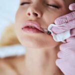 The Benefits of Hyaluronic Filler Treatments